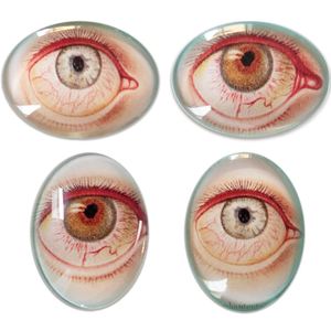 Anatomical Diseases of the Eye Cameo Cabochon