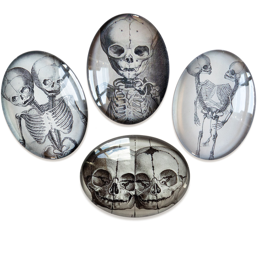 Conjoined Twins Anatomical Oddities Glass Cameo Cabochon