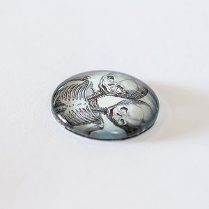 Anatomical Twins Skeleton Illustration Round Glass Cameo Cabochon